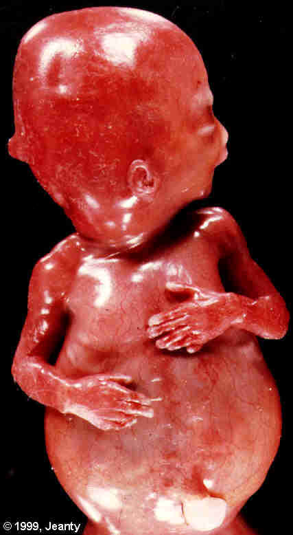 image009