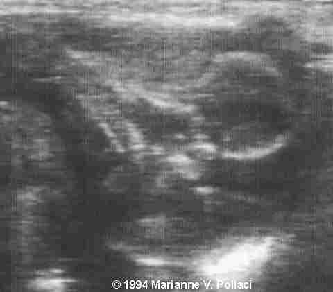 image36