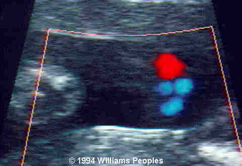 image38