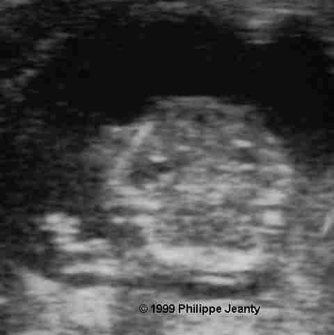 image39