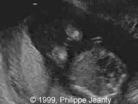 image4