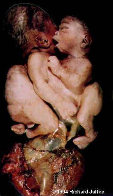 image44