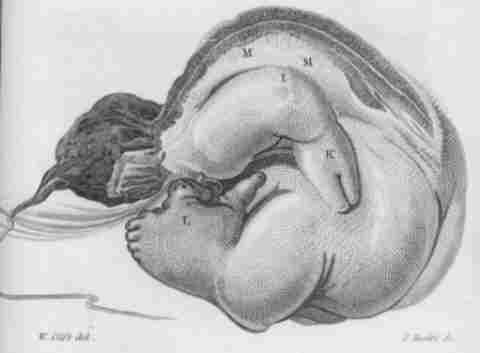 image6