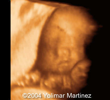 Imagen 24