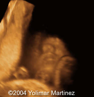 Imagen 25