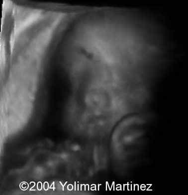 Imagen 28