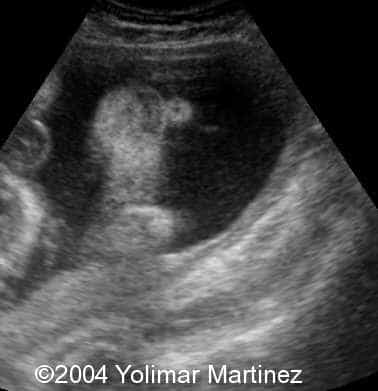 Imagen 40