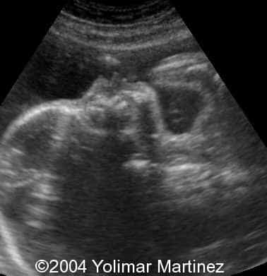 Imagen 44