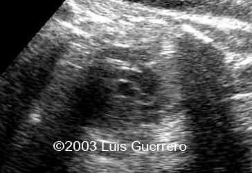 Imagen1