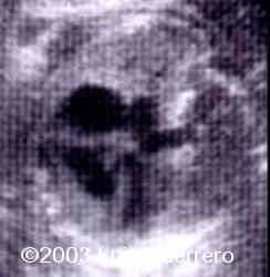 Imagen2