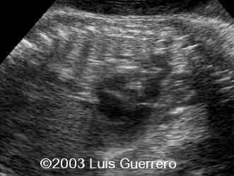 Imagen3