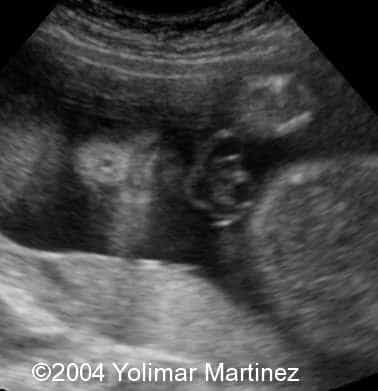 Imagen4