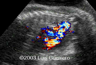 Imagen4