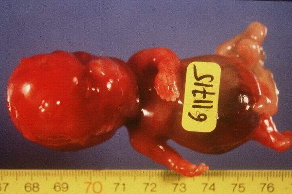 img001