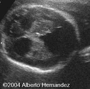 img1