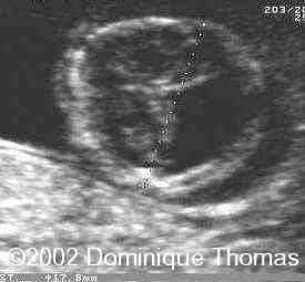 ini, fig1