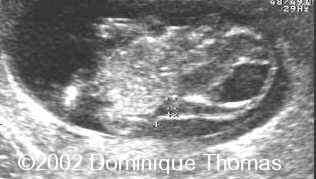 ini, fig4