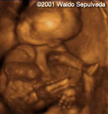 jaime5