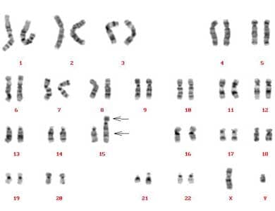 karyotype_1