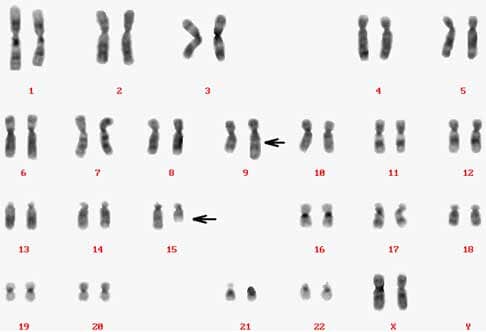 karyotype