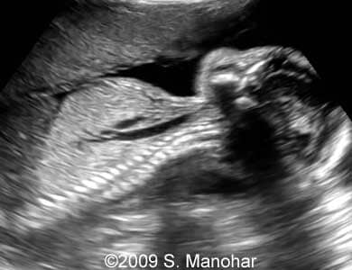 Larynx_7