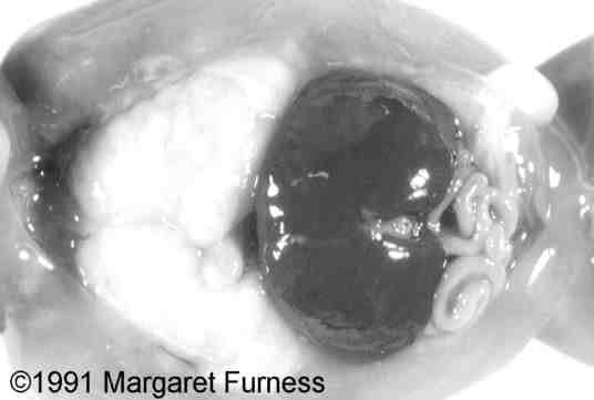 larynx3