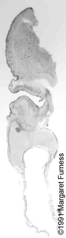 larynx4