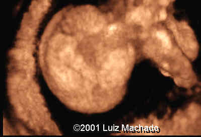 lbwc-22