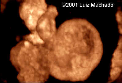 lbwc-23