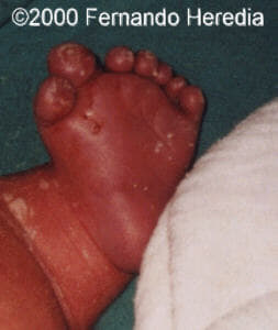 left foot