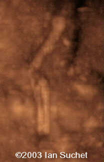Leg abn 3