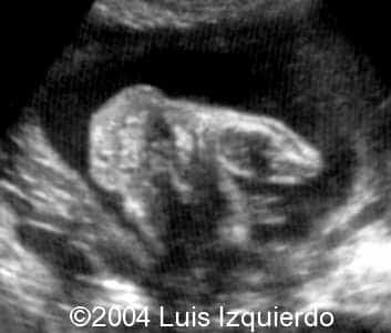 lL3