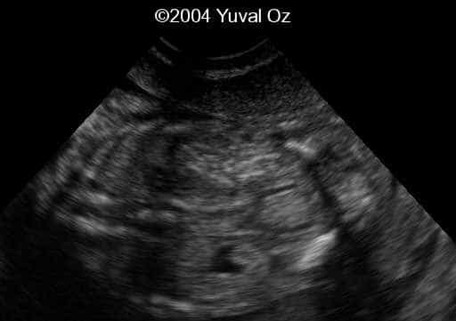 Lt P Kidney Rt Blood Sup (10)