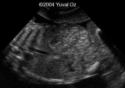 Lt P Kidney Rt Blood Sup (11)