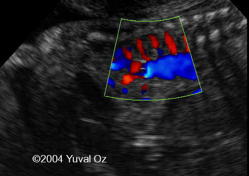 Lt P Kidney Rt Blood Sup (3)