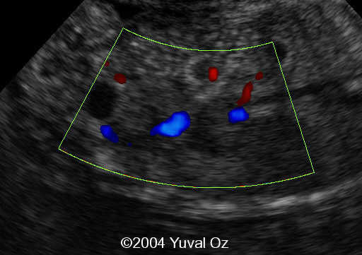 Lt P Kidney Rt Blood Sup (7)