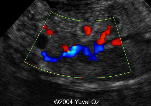 Lt P Kidney Rt Blood Sup (8)