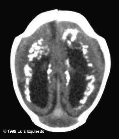mri-1