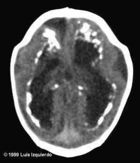 mri-2