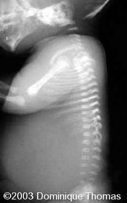 nanismerx colonne+