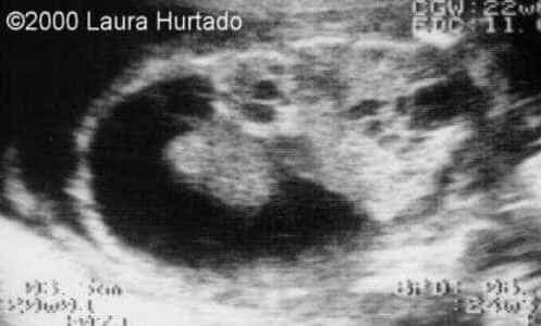 navarro2a