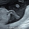 Case of the Week #654
