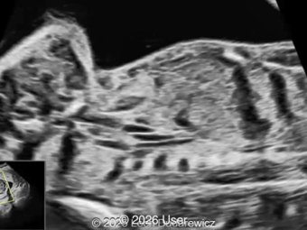 Case of the Week #642