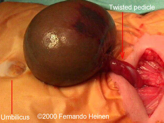 photo10_intraop