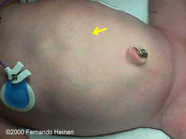 photo2