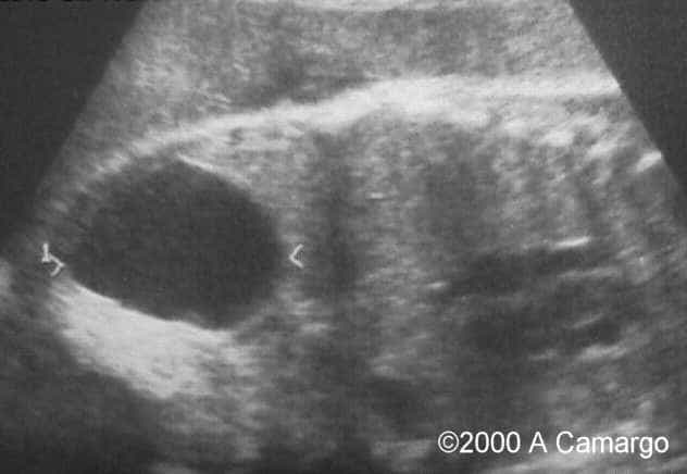 photo4_unilocular