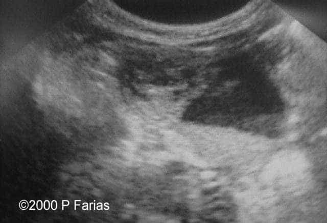photo5_postnatal
