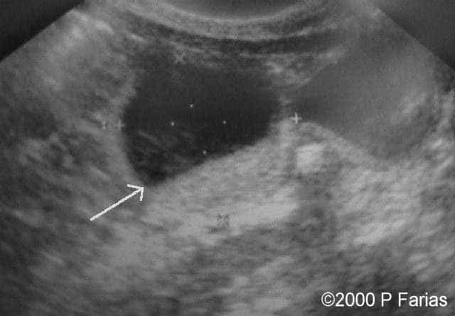 photo6_postnatal_70d