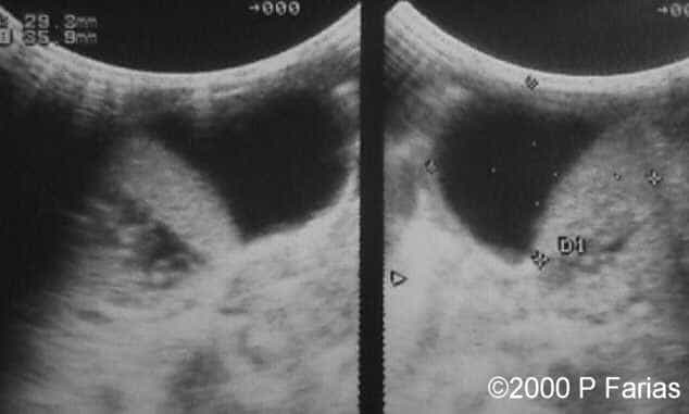 photo7_postnatal_50_d