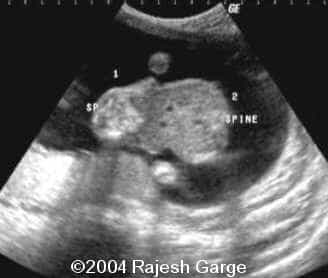 pic2a